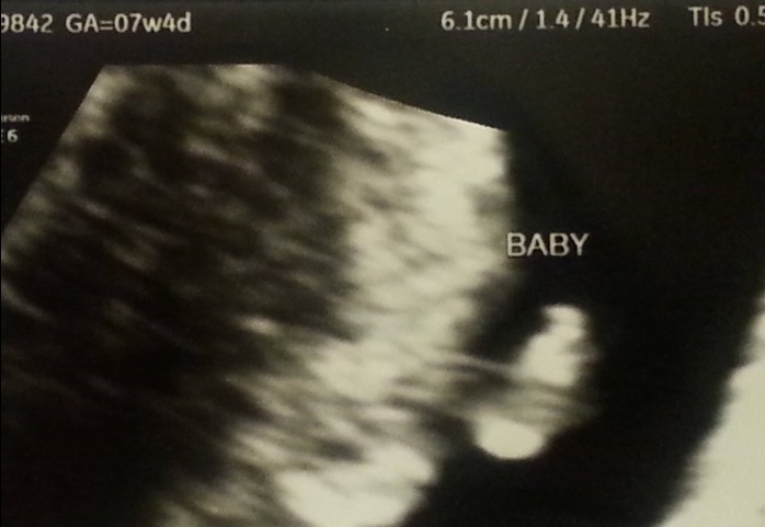 baby 6 us May 2015